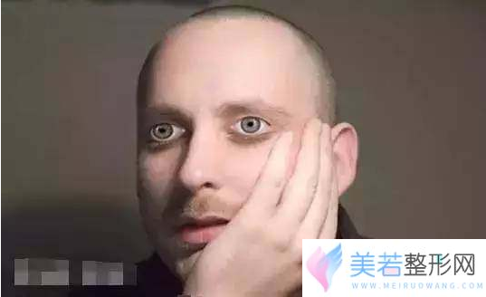 男性开眼角开大了图片