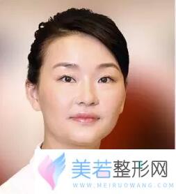 上海浦东新区华美医院整形医生叶丽萍