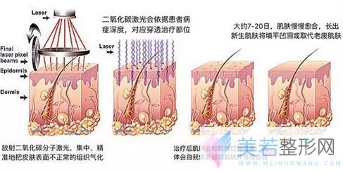 汗管瘤的调节方法有哪些安？我查到了这些资料~