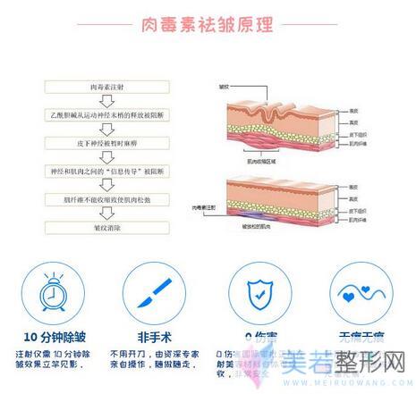 注射瘦脸除皱原理