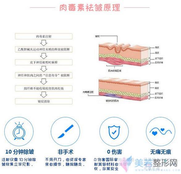 注射瘦脸除皱的原理