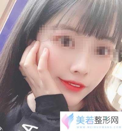 杭州三医院激光美容中心案例