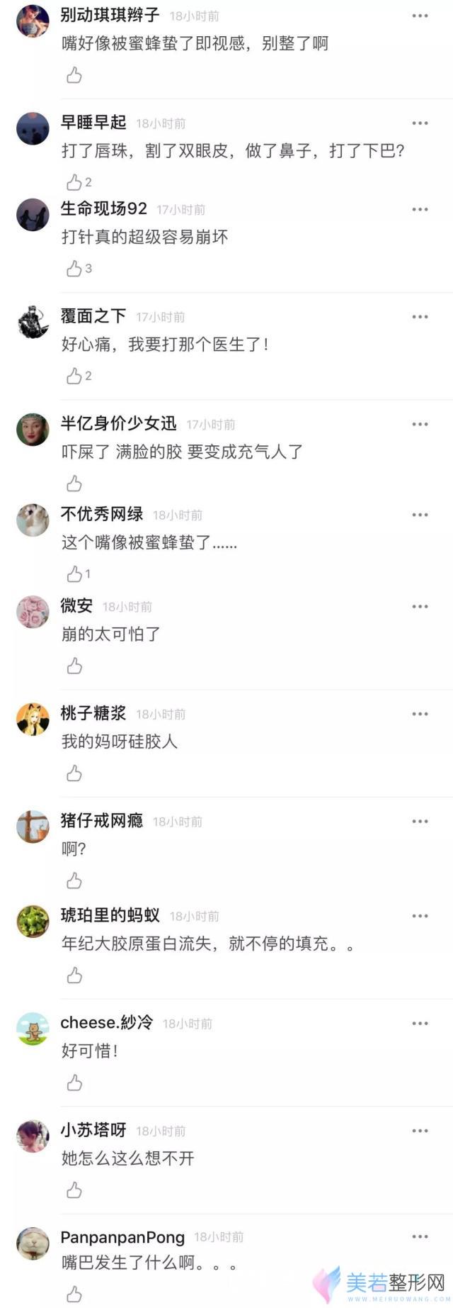 王心凌整容是真是假？|“渣男收割机”王心凌甜美脸蛋将彻底崩掉？