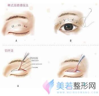 荆州蓝鸟整形医院崭新价格表上线