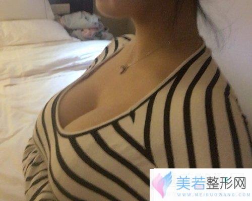 北京韩啸医院怎么样？靠谱吗？附全新价格表及案例展示