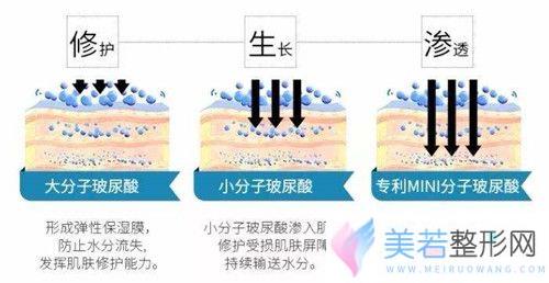 玻尿酸不同分子的作用不同