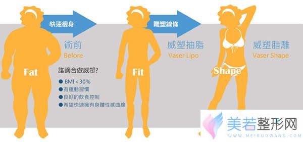 威塑吸脂和水动力吸脂区别介绍