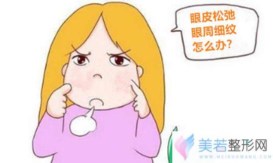 眼皮松弛眼周细纹卡通图