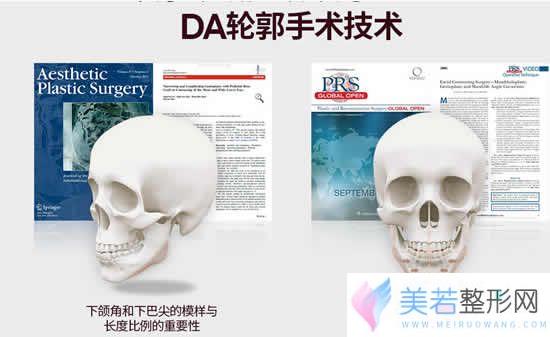 韩国da轮廓手术技术特色