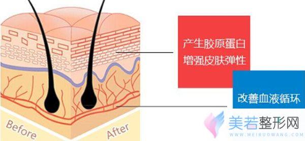 韩国威宁P丙二醇新品线材