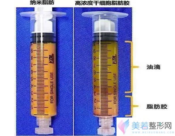 纳米脂肪和脂肪胶图片