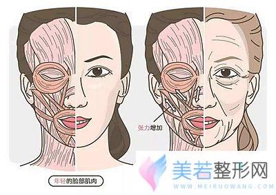 面部松弛、下垂的原因