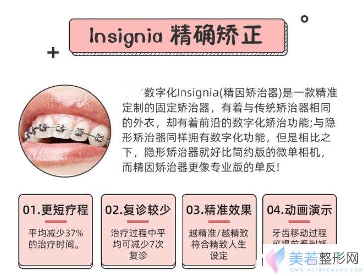  Insignia较准矫正的优缺点