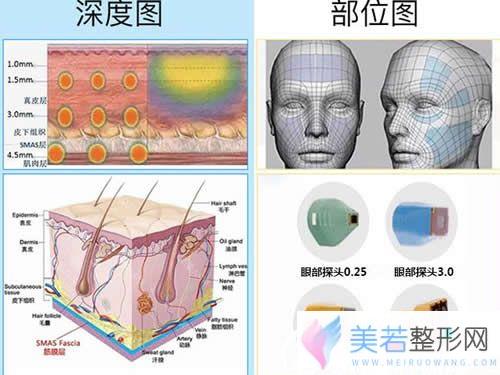 热玛吉工作原理