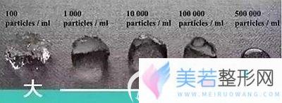 大分子玻尿酸和小分子玻尿酸的区别