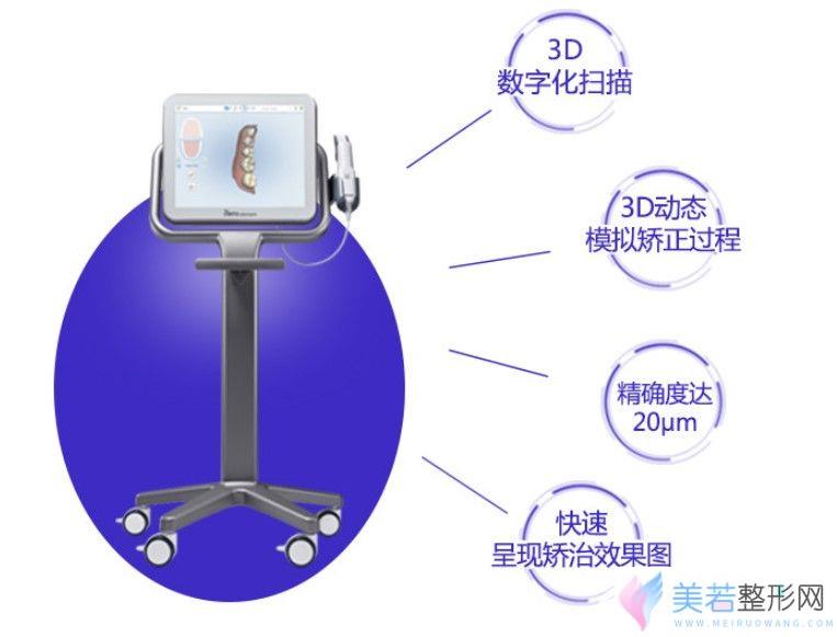 先进的口腔设备—itero口扫