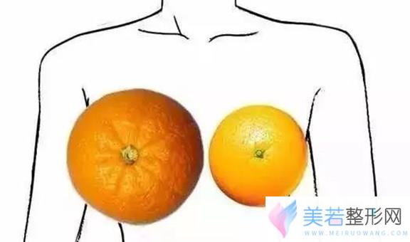 乳房大小