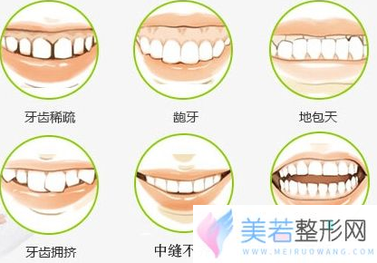 牙齿矫正