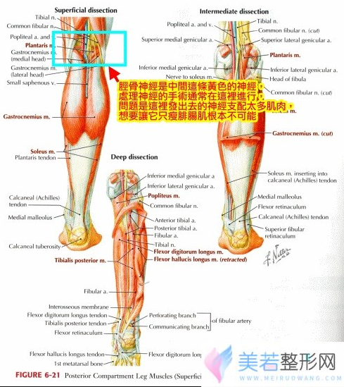 瘦小腿