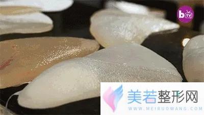 图片来源：新氧