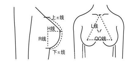 失败隆胸修复术前需要体检吗？禁忌症有哪些？