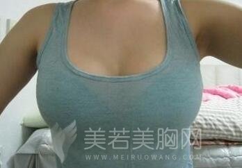 乳房松弛下垂该怎么办?