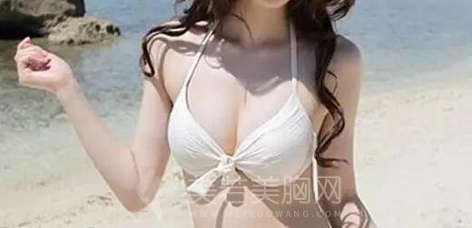 娜高假体丰胸的实际果如何?