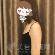 韩式微创丰胸术后恢复记录手册【图】