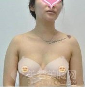 做水滴型乳房是什么感受？拥有妙龄少女般的胸部