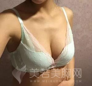 成都铜雀台整形美容医院怎么样？隆胸案例分享~