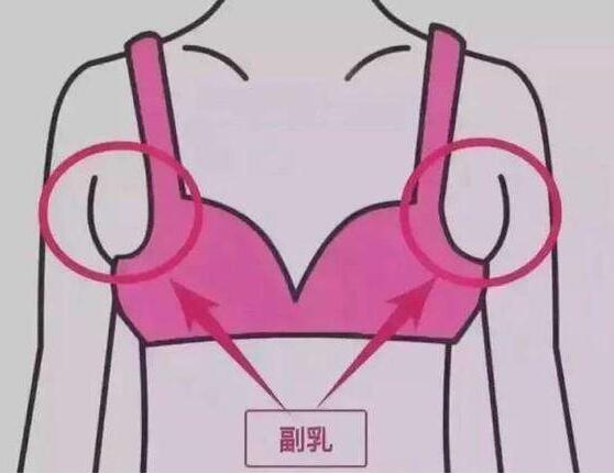 去副乳