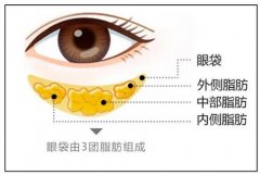 眼袋和卧蚕的区别原来是这里，灵动眼神就靠它了