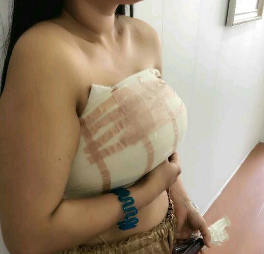 蒋思军医生巨乳缩小案例