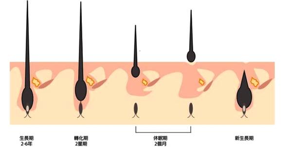 头顶能植发吗？果好吗？会不会留下疤痕呀？