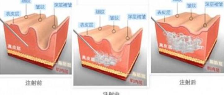 戴斯波特的批准历史