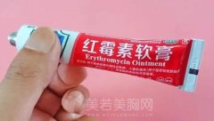 红霉素软膏祛痘有用吗？了解相关的资料详情