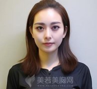 面部吸脂后遗症有哪些？收藏相关科普知识